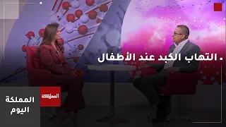 التهاب الكبد عند الأطفال.. بين الأعراض والمضاعفات