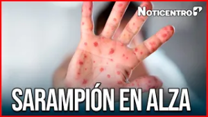 Polémica en instituto federal de México en plena crisis por sarampión y estalla el debate nacional