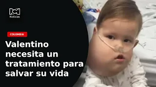 Valentino, a one-year-old boy, requires a special intervention to save his life