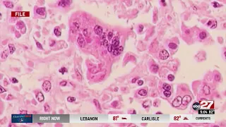 State Rep. sounding the alarm about Measles vaccine rates
