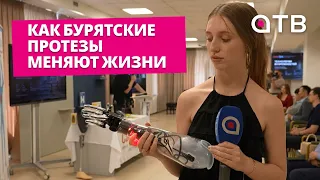 Как бурятские протезы меняют жизни