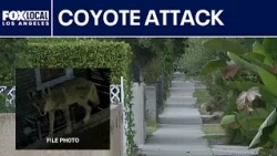 Toddler bitten by coyote in Los Angeles