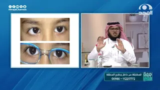 بدون جراحة! متى تكون النظارة هي العلاج الوحيد لحول العين؟