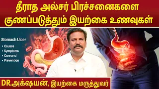தீராத அல்சர் பிரச்சனைகளை குணப்படுத்தும் இயற்கை உணவுகள் | Ulcer Problem | Dr.Akshayan |