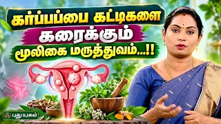 🌿 கர்ப்பப்பை கட்டிகளை கரைக்கும் மூலிகை மருத்துவம்...! 🌸 Dr. Saranya | Doctor On Call | Puthuyugam TV