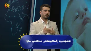 نەخۆشییە زگماکییەکانی منداڵانی ساوا