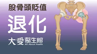 【大愛醫生館】 股骨頭貶值 20260630