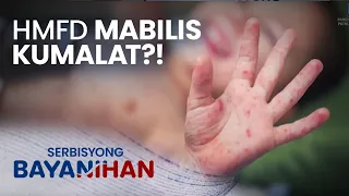 HFMD, mabilis kumalat! Ito ang dapat gawin ng mga magulang!