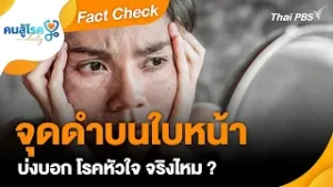 จุดดำบนใบหน้า บ่งบอก โรคหัวใจ ? | Fact Check | คนสู้โรค