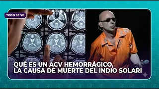 Qué es un ACV hemorrágico, la causa de muerte del Indio Solari