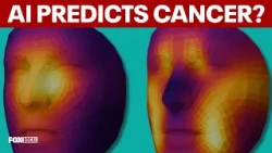 How AI can predict cancer survival from a single photo of a face