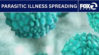 Parasite causing major stomach symptoms is spreading | KTVU