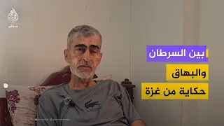 Between Cancer and Vitiligo: The Story of an Elderly Man from Gaza