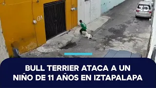 11-Year-Old Boy Attacked by Dog in San Miguel, Iztapalapa; Leg Bitten