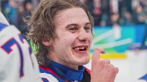 9@9: Smile, it's Tuesday! And here's what happens when hockey players get their teeth knocked out