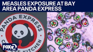 Measles exposure at Bay Area Panda Express restaurant | KTVU
