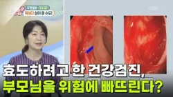 [의학 팩트체크] 효도하려고 한 건강검진, 부모님을 위험에 빠뜨린다? [무엇이든 물어보세요] | KBS 261012 방송