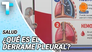 What is PLEURAL EFFUSION? DR. SABAGH explains its CAUSES and TREATMENT