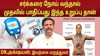 சர்க்கரை நோய் வந்தால் முதலில் பாதிப்பது இந்த உறுப்பு தான் | Dr.Akshayan | #diabetes