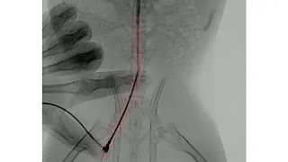 This tiny robot could help deliver drugs, dissolve blood clots and detect cancer