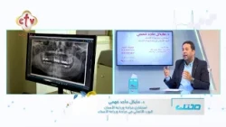الأشعة خطوة مهمة في خطة علاج أسنانك بتقيم حالة السنة والفك لاختيار العلاج الأنسب ليك | صحتك