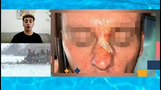 Brutal attack by radicals on a family in Ceuta: "They tried to hang me"