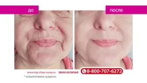 Сыворотка для коррекции морщин с золотом «Актив» TRAVOPAR