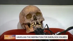 The Real Medical Detective Who Inspired Sherlock Holmes