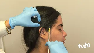 TVE NEWS 08/17/2026 CHRONIC MIGRAINE TREATMENT
