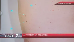 Új terápiás lehetőségeket vitattak meg a Regionális Bőrgyógyászati és Allergológiai Fórumon