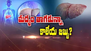 మద్యం తాగకున్నా కాలేయ జబ్బు ? | Liver disease event without drinking Alcohol | Sukhibhava | ETV Life