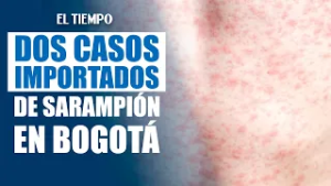 Confirman casos importados de sarampión en Colombia: dos están en Bogotá | EL TIEMPO