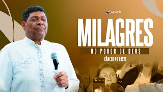 MIRACLE: FACIAL CANCER