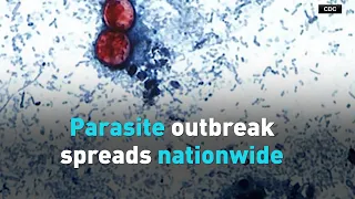 Parasite outbreak spreads nationwide