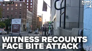 Valet intervened as suspect bit off woman's forehead in downtown Seattle attack