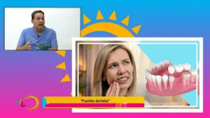 Puentes Dentales, qué son y cuidados