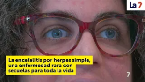 La encefalitis por herpes simple, una enfermedad rara con secuelas para toda la vida | La 7