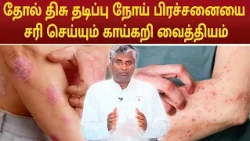 தோல் திசு தடிப்பு நோய் பிரச்சனையை சரி செய்யும் காய்கறி வைத்தியம் | B.K.Arun Prakash |