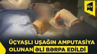 Üçyaşlı uşağın amputasiya olunan əli əməliyyatla bərpa edilib