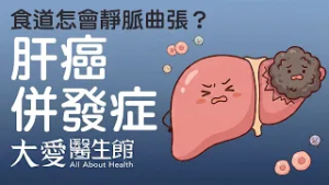 【大愛醫生館】 食道怎會靜脈曲張？ 20260224
