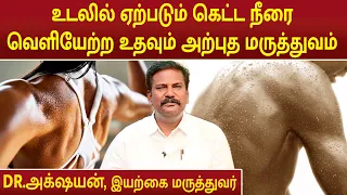 உடலில் ஏற்படும் கெட்ட நீரை வெளியேற்ற உதவும் அற்புத மருத்துவம் | Dr.Akshayan |