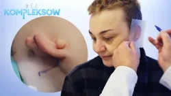Zrobili jej UCHO Z ŻEBRA? 😮 Chirurg rysował je od zera! | Bez kompleksów