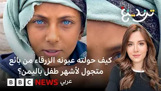 كيف حولته عيونه الزرقاء من بائع متجول لأشهر طفل باليمن؟