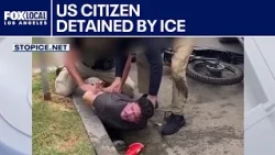 Man says ICE broke his arm in Long Beach