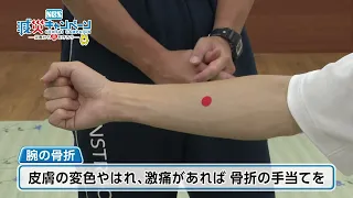 Life-Saving First Aid Techniques Part 2: Treating Limb Injuries