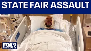 Oakdale man assaulted at MN State Fair