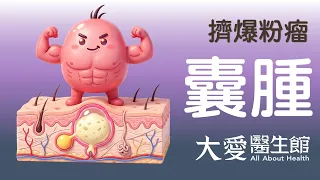 【大愛醫生館】 擠爆粉瘤 20260701