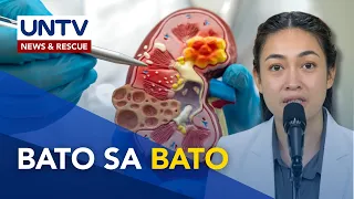 Paano nakukuha ang kidney stones o bato at paano ito maiiwasan? | Good Morning Kuya