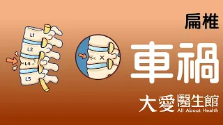 【大愛醫生館】 扁椎 20260814