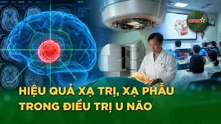 The Power of Modern SRS Radiosurgery in Brain Tumor Treatment | QPVN